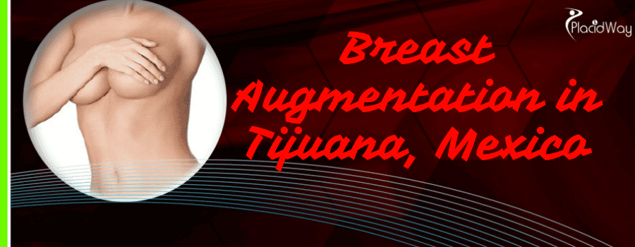 Best Breast Augmentation Surgeons in Tijuana Mexico
